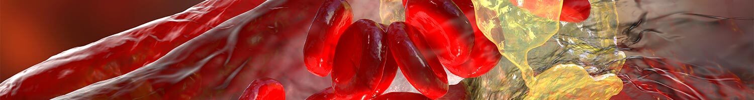 Cardiovascular Atherosclerosis 2026: Prediction, Prevention and Management CME Course-San Diego, CA